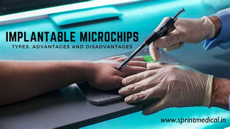 how the rfid chip is implanted|The microchip implants that let you pay with your .